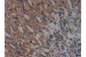 Immunohistochemistry (IHC) image for anti-Glutathione S-Transferase kappa 1 (GSTK1) (AA 19-222) antibody (ABIN7440020)