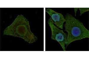 Confocal immunofluorescence analysis of MCF-7 (left) and HepG2 (right) cells using BRAF mouse mAb (green). (BRAF 抗体)