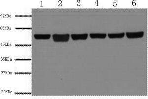 Western Blotting (WB) image for anti-Tubulin, beta (TUBB) antibody (ABIN6566394) (TUBB 抗体)