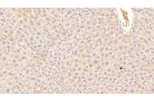 Detection of C3a in Mouse Liver Tissue using Polyclonal Antibody to Complement Component 3a (C3a) (C3a 抗体  (AA 671-748))
