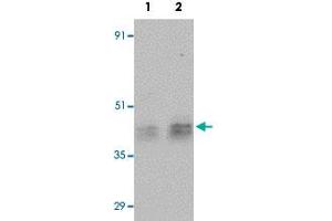 Western blot analysis of human testis tissue with ESX1 polyclonal antibody  at (Lane 1) 1 and (Lane 2) 2 ug/mL dilution.