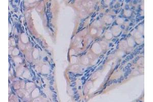 Used in DAB staining on fromalin fixed paraffin- embedded testis tissue (Fatty Acid Synthase 抗体  (AA 2257-2504))