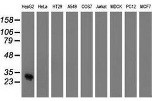 Western blot analysis of extracts (35 µg) from 9 different cell lines by using anti-OTUB2 monoclonal antibody. (OTUB2 抗体)