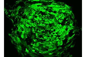 Immunofluorescent staining of human ES cell line. (TRA1-81 抗体)