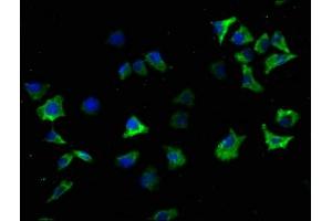 Immunofluorescence staining of SH-SY5Y cells with ABIN7139719 at 1:100, counter-stained with DAPI.