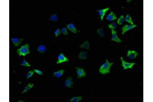 Immunofluorescence staining of SH-SY5Y cells with ABIN7139719 at 1:100, counter-stained with DAPI. (SNCA 抗体  (AA 119-136))