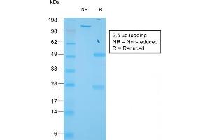 SDS-PAGE Analysis of Purified TIMP1 Rabbit Recombinant Monoclonal Antibody (TIMP1/1944R). (Recombinant TIMP1 抗体)