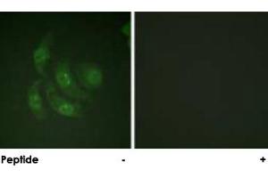 Immunofluorescence analysis of HepG2 cells, using CAMK4 polyclonal antibody . (CAMK4 抗体)
