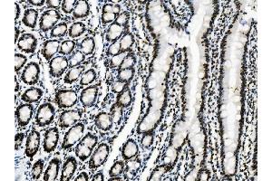 IHC analysis of SORBS3 using anti-SORBS3 antibody (ABIN7603121).