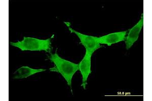 Immunofluorescence of monoclonal antibody to DCAMKL1 on NIH/3T3 cell. (DCLK1 抗体  (AA 640-729))