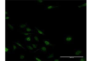 Immunofluorescence of purified MaxPab antibody to MSX2 on HeLa cell. (Msx2/Hox8 抗体  (AA 1-267))