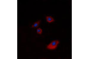 Immunofluorescent analysis of Cytokeratin 20 staining in A549 cells. (KRT20 抗体  (C-Term))