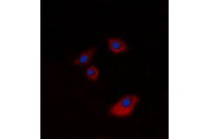 Immunofluorescent analysis of Cytokeratin 20 staining in A549 cells.