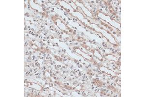 Immunohistochemistry (IHC) image for anti-Zinc Finger Protein 581 (ZNF581) (AA 1-90) antibody (ABIN6150520)