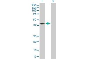 Western Blot analysis of CD58 expression in transfected 293T cell line by CD58 MaxPab polyclonal antibody. (CD58 抗体  (AA 1-250))