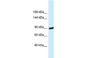 WB Suggested Anti-Dnm3 Antibody Titration: 1. (Dynamin 3 抗体  (C-Term))