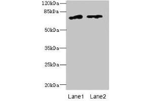 Western blot All lanes: ENOX1 antibody at 5 μg/mL Lane 1: Jurkat whole cell lysate Lane 2: Raji whole cell lysate Secondary Goat polyclonal to rabbit IgG at 1/10000 dilution Predicted band size: 74, 28 kDa Observed band size: 74 kDa (ENOX1 抗体  (AA 101-340))