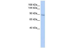 IREB2 antibody used at 1 ug/ml to detect target protein. (IREB2 抗体  (Middle Region))