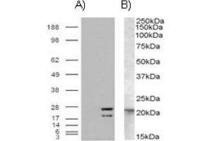 Image no. 1 for anti-GTPase NRas (NRAS) (Internal Region) antibody (ABIN375000)
