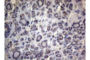 Image no. 3 for anti-Mitofusin 1 (MFN1) (AA 209-469) antibody (ABIN1491184) (MFN1 抗体  (AA 209-469))
