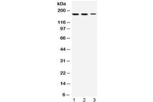Western blot testing of 1) rat testis, 2) mouse testis and 3) human HepG2 lysate with KDM5B antibody at 0.