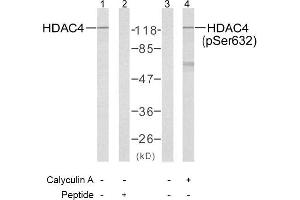 Image no. 1 for anti-Histone Deacetylase 4 (HDAC4) (pSer632) antibody (ABIN196930) (HDAC4 抗体  (pSer632))