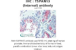 Image no. 1 for anti-Tetraspanin 13 (TSPAN13) (Internal Region) antibody (ABIN1740425) (TSPAN13 抗体  (Internal Region))