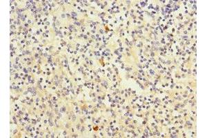 Immunohistochemistry of paraffin-embedded human spleen tissue using ABIN7147155 at dilution of 1:100 (Fc gamma RII (CD32) (AA 36-229) 抗体)