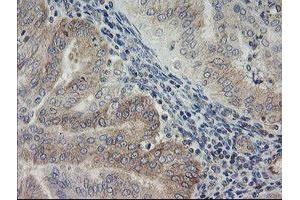 Immunohistochemistry (IHC) image for anti-ATP/GTP Binding Protein 1 (AGTPBP1) (AA 368-753) antibody (ABIN1491460) (AGTPBP1 抗体  (AA 368-753))
