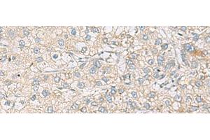 Immunohistochemistry (Paraffin-embedded Sections) (IHC (p)) image for anti-Ras-Related C3 Botulinum Toxin Substrate 2 (Rho Family, Small GTP Binding Protein Rac2) (RAC2) antibody (ABIN7254364)