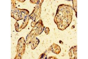 Immunohistochemistry of paraffin-embedded human placenta tissue using ABIN7176020 at dilution of 1:100 (ZBED1 抗体  (AA 1-210))