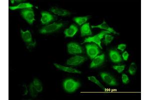 Immunofluorescence of monoclonal antibody to CAPG on HeLa cell. (CAPG 抗体  (AA 249-348))