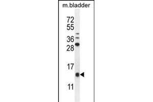 KT Antibody (C-term) (ABIN655129 and ABIN2844756) western blot analysis in mouse bladder tissue lysates (35 μg/lane). (KRTCAP2 抗体  (C-Term))