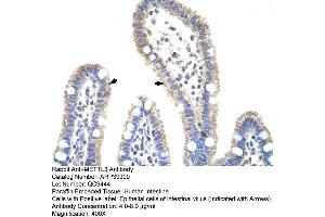 Human Intestine (METTL3 抗体  (N-Term))