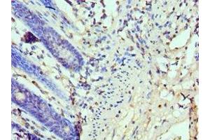 Immunohistochemistry of paraffin-embedded human colon tissue using ABIN7173934 at dilution of 1:100 (TP53BP1 抗体  (AA 1758-1972))