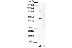 Western Blotting (WB) image for anti-SRY (Sex Determining Region Y)-Box 4 (SOX4) (N-Term) antibody (ABIN2780469)