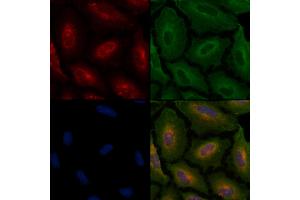 ABIN6258097 and ABIN6274226 staining  cells by IF/ICC. (PPIF 抗体  (Internal Region))