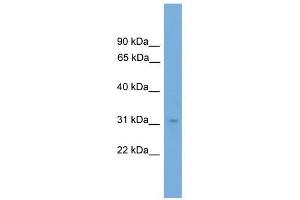 NRBF2 antibody used at 1 ug/ml to detect target protein. (NRBF2 抗体  (N-Term))