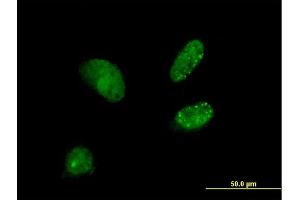 Immunofluorescence of purified MaxPab antibody to DCTN3 on HeLa cell. (DCTN3 抗体  (AA 1-176))
