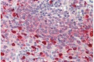 Human Spleen: Formalin-Fixed, Paraffin-Embedded (FFPE)