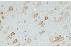 Immunohistochemistry of paraffin-embedded Rat brain using DDX3X Polyclonal Antibody at dilution of 1:100 (40x lens). (DDX3X 抗体)