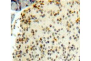 Used in DAB staining on fromalin fixed paraffin-embedded Pancreas tissue (CENPH 抗体  (AA 1-247))