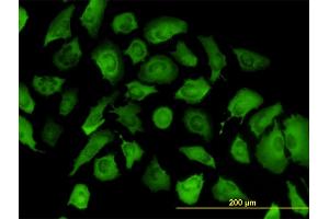 Immunofluorescence of monoclonal antibody to ANXA2 on HeLa cell. (Annexin A2 抗体  (AA 19-357))