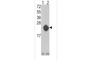 Western blot analysis of IL1RN (arrow) using rabbit polyclonal IL1RN Antibody (Center) (ABIN390396 and ABIN2840788).
