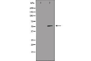 Western blot analysis of extracts from HeLa cells, using RSAD1 antibody. (RSAD1 抗体  (Internal Region))