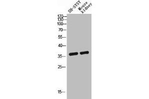 Western blot analysis of SH-SY5Y mouse-kidney lysis using GPR119 antibody. (G Protein-Coupled Receptor 119 抗体  (Internal Region))