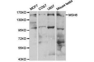 Western Blotting (WB) image for anti-MutS Homolog 6 (E. Coli) (MSH6) antibody (ABIN1873753) (MSH6 抗体)