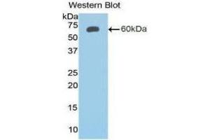 Western Blotting (WB) image for anti-Insulin-Like Growth Factor Binding Protein 2, 36kDa (IGFBP2) (AA 24-305) antibody (ABIN1172088) (IGFBP2 抗体  (AA 24-305))