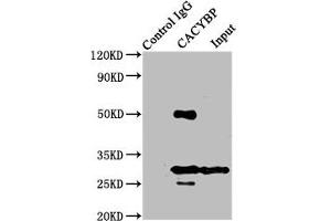 Immunoprecipitating CACYBP in Hela whole cell lysate Lane 1: Rabbit control IgG instead of ABIN7146450 in Hela whole cell lysate.