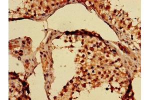 Immunohistochemistry (IHC) image for anti-Tyrosyl-tRNA Synthetase (Yars) (AA 2-528) antibody (ABIN7173996)